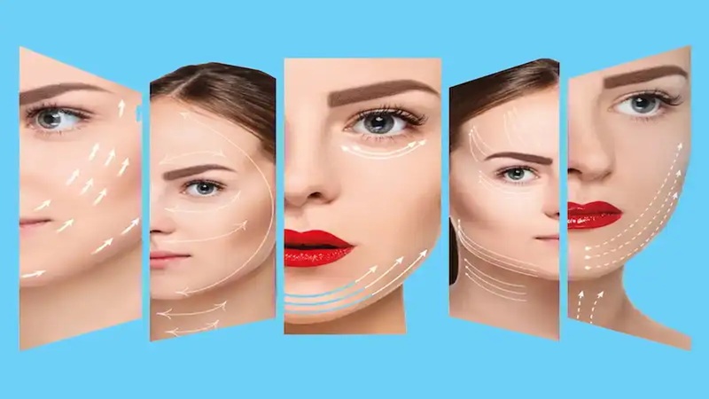 آشنایی با لیفت با نخ