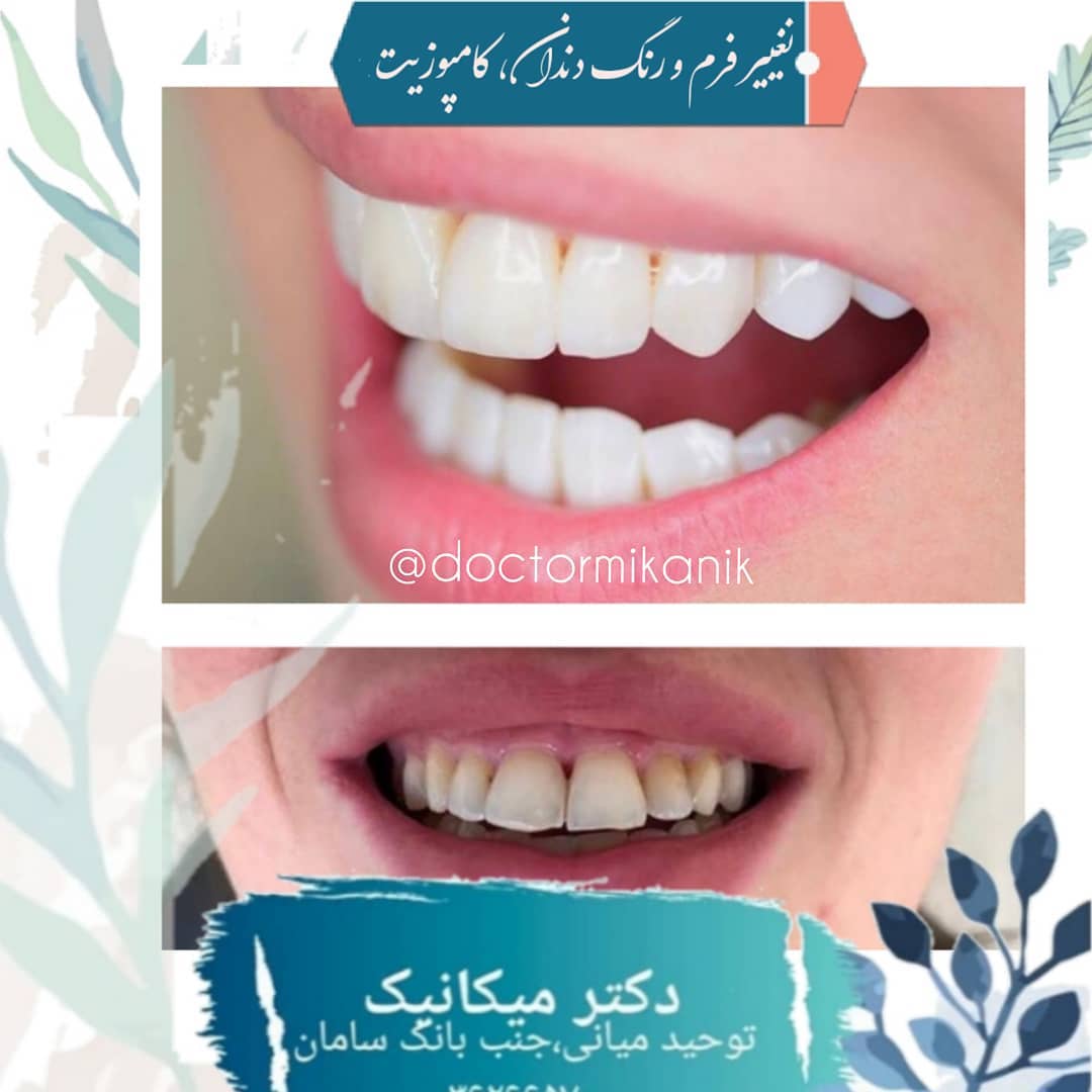 تغییر فرم و رنگ دندانهای مراجعه کننده