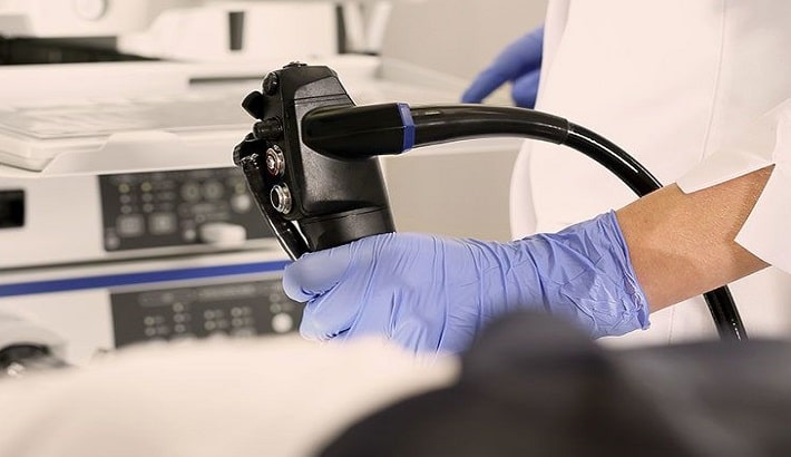 برداشتن پولیپ‌های دستگاه گوارش با کولونوسکوپی: روش، مزایا و نکات مهم