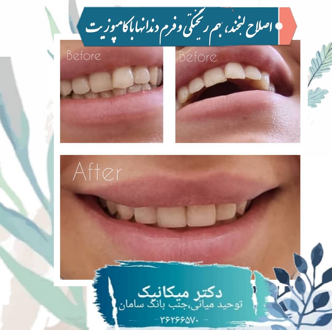 نمونه اصلاح طرح لبخند