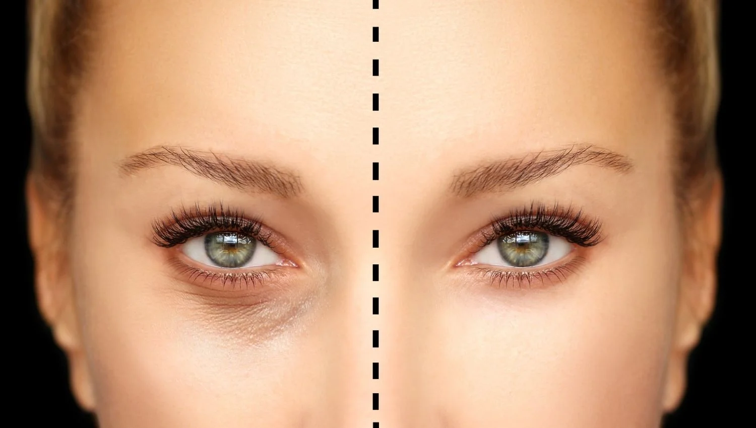 آینده بوتاکس و فناوری‌های نوین در جوانسازی پوست