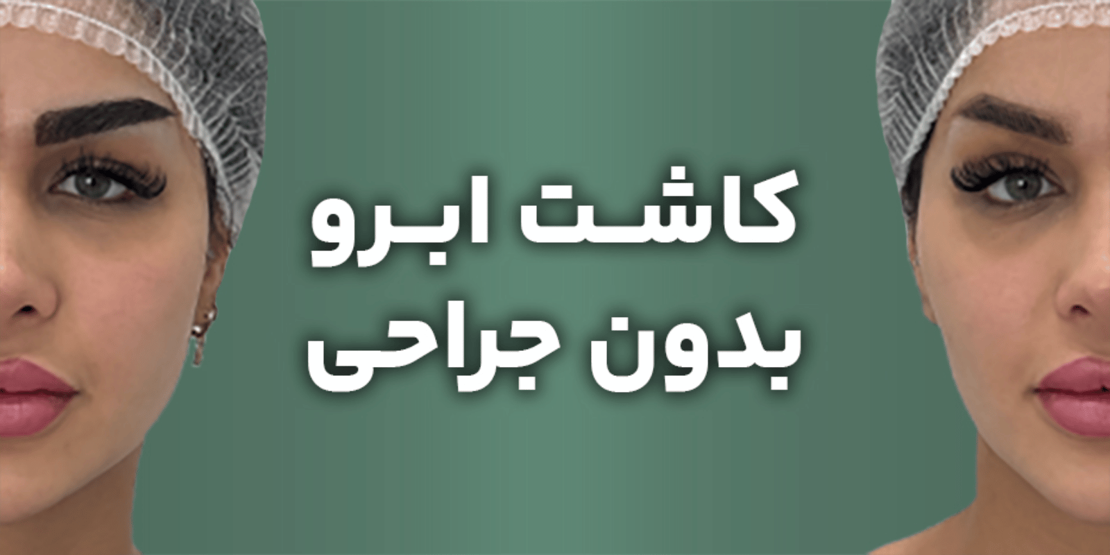 کاشت ابرو بدون جراحی و دوران نقاهت در کلینیک تخصصی پوست، مو و زیبایی.