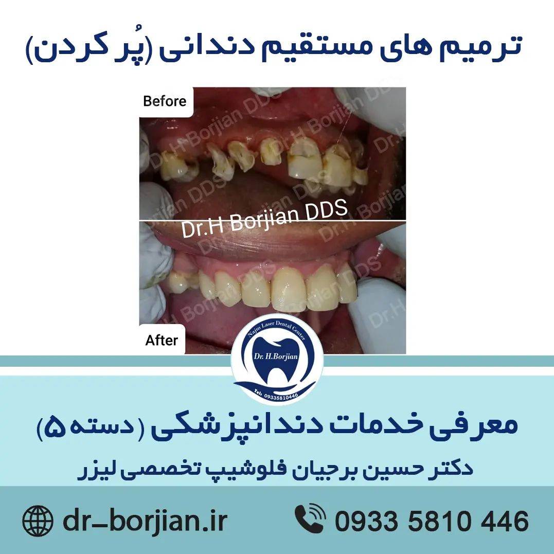 معرفی خدمات دندانپزشکی (دسته 5)