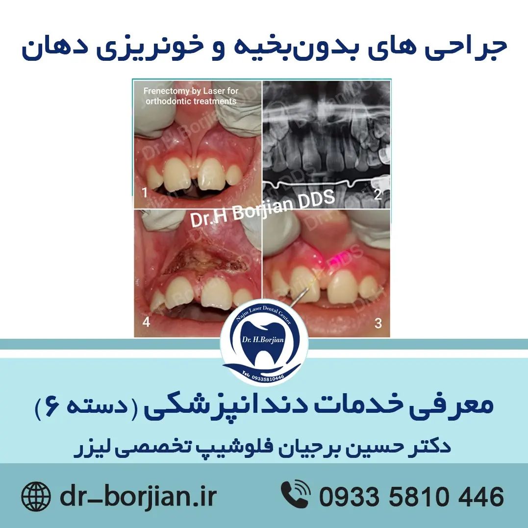 معرفی خدمات دندانپزشکی (دسته 6)
