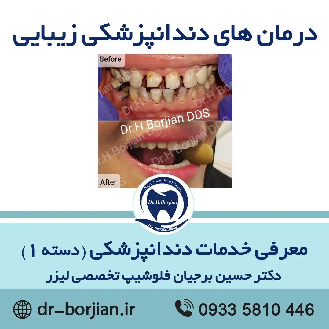 معرفی خدمات دندانپزشکی (دسته 1)